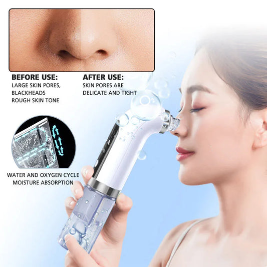 Water Circulation Face Vacuum Cleaner Electric Bubble Cleanser Blackhead Remover Pore Extractor Beauty Skin Care