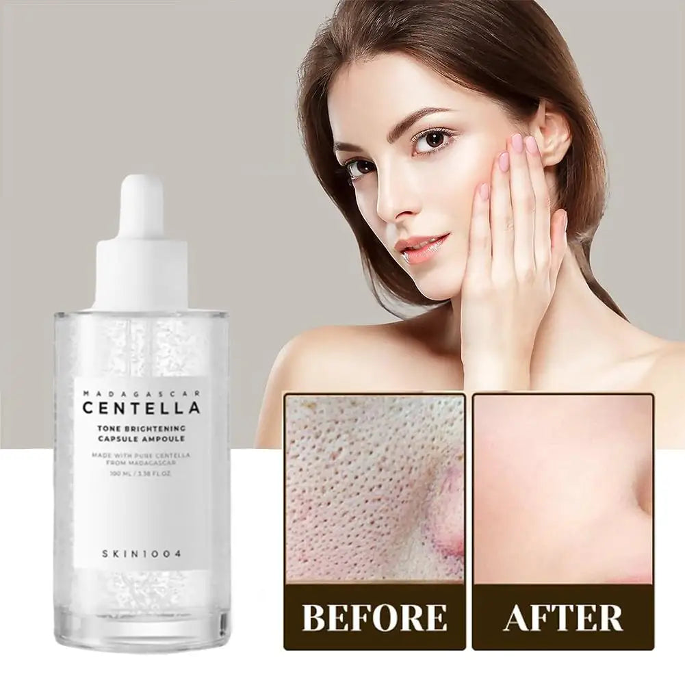 Centella - Tone Brightening Ampoule (Original)