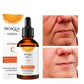 Vitamin C Serum (100ml)