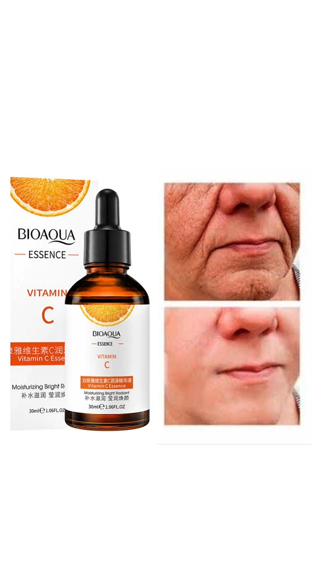 Vitamin C Serum (100ml)